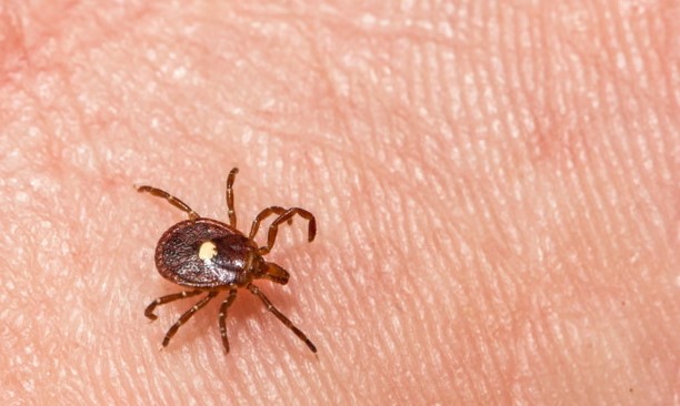 Una Trágica Primera Vez: Piloto de Nueva Jersey es la Primera Muerte Conocida por Rara Alergia a la Carne Transmitida por Garrapatas